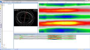 Laser 5 200826 122253