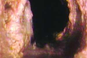 Eliminating Sewer System FOG