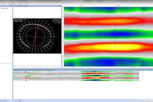 Laser 5 200826 122253