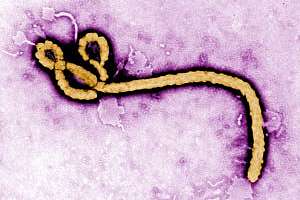 Ebola virus cdc 171030 130601